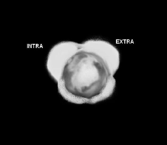 Flou turbulence intra extrafocal.