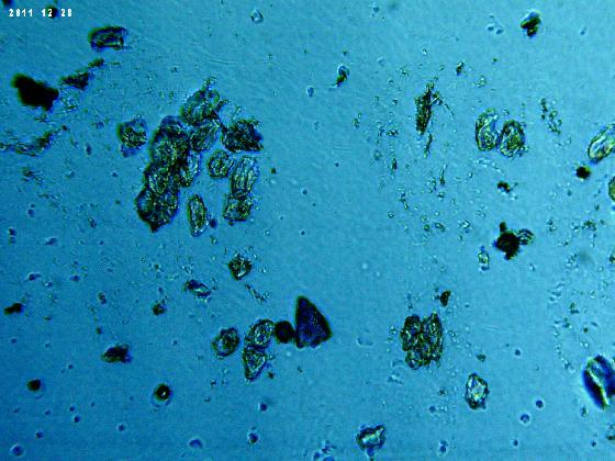 ECHT 59 B MICROPARTICULE EN LPA ECHT 59 B MICROPARTICULE EN LPA