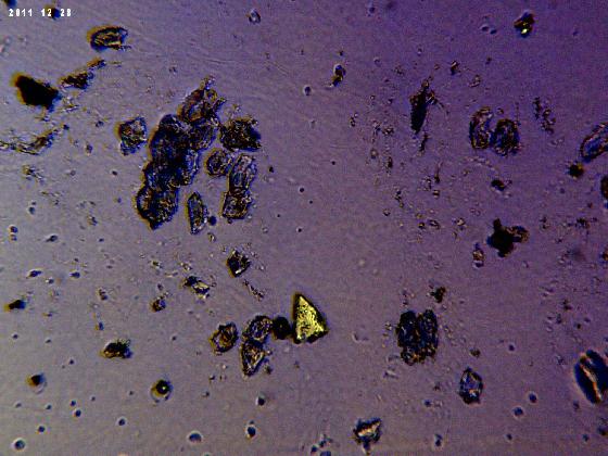 ECHT 59 B MICROPARTICULES EN LPA ECHT 59 B MICROPARTICULES EN LPA