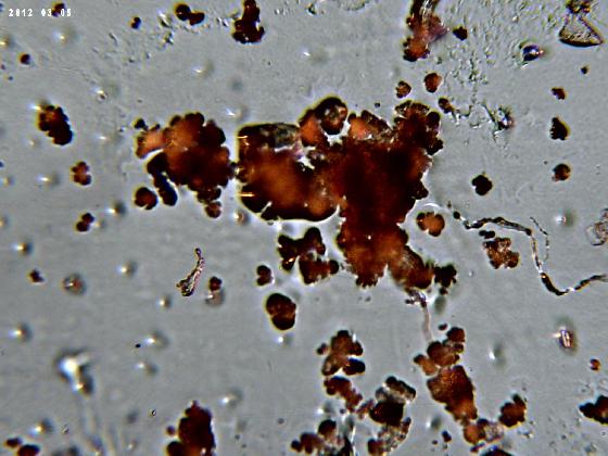 ECHT 62 B MICROPARTICULES 