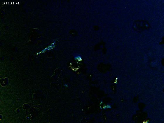 ECHT 62 B MICROPARTICULES  L P A