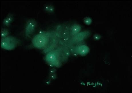 Pleiades Pleiades