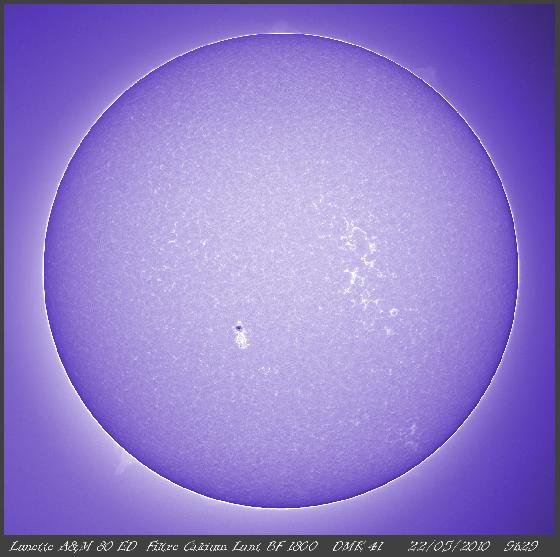 Protubérances en Calcium