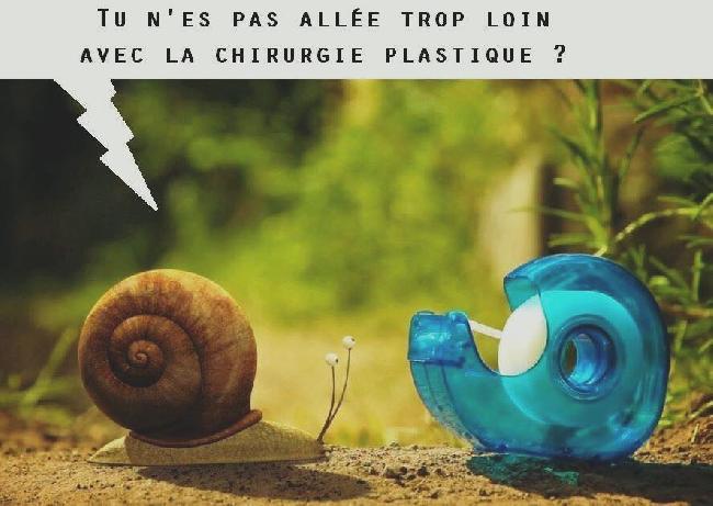 escargot plastique