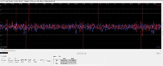 HEQ 5 Pro GoTo et accessoires