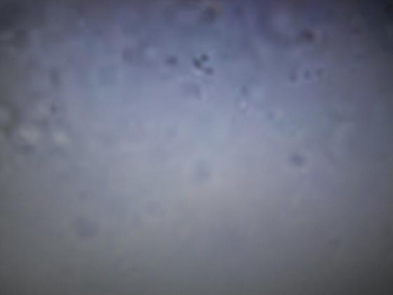 Micro organismes avec la lave de Lanzarote 