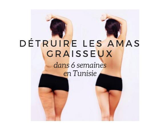 Chirurgie esthétique Tunisie