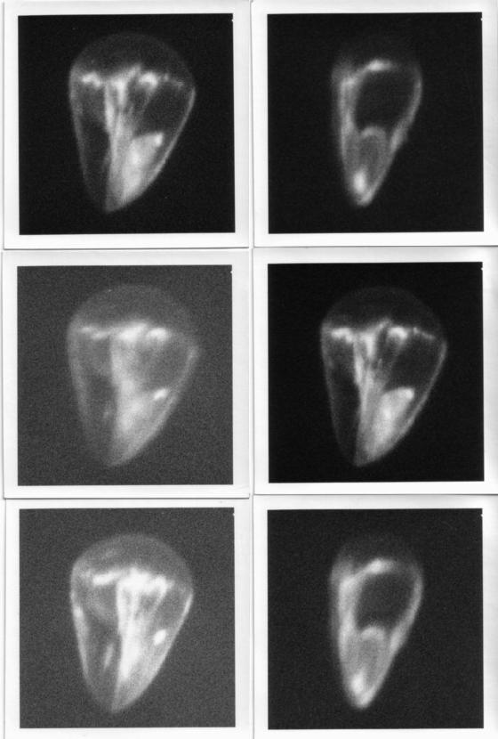 Ballon stratosphérique 1978