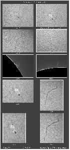observation du 07-06