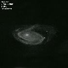 ngc 157 par Serge Vieillard