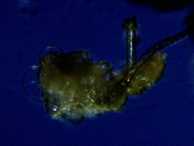 DEBRIS DE PUCERONS MICROSCOPE 100X 