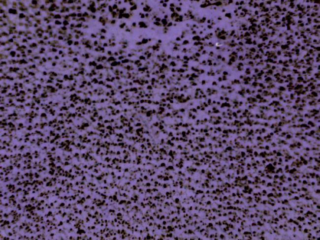 IMAGE FEUILLE PRIMAIRE DE COLSA MICRO 40X