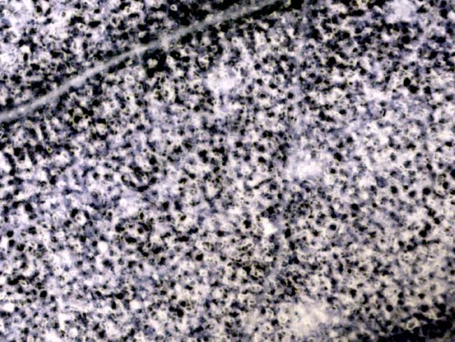 FEUILLE DE CRESSON MICRO 40X 