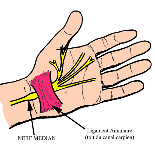 Nerf-median-poignet-canal-carpien-schema.jpg