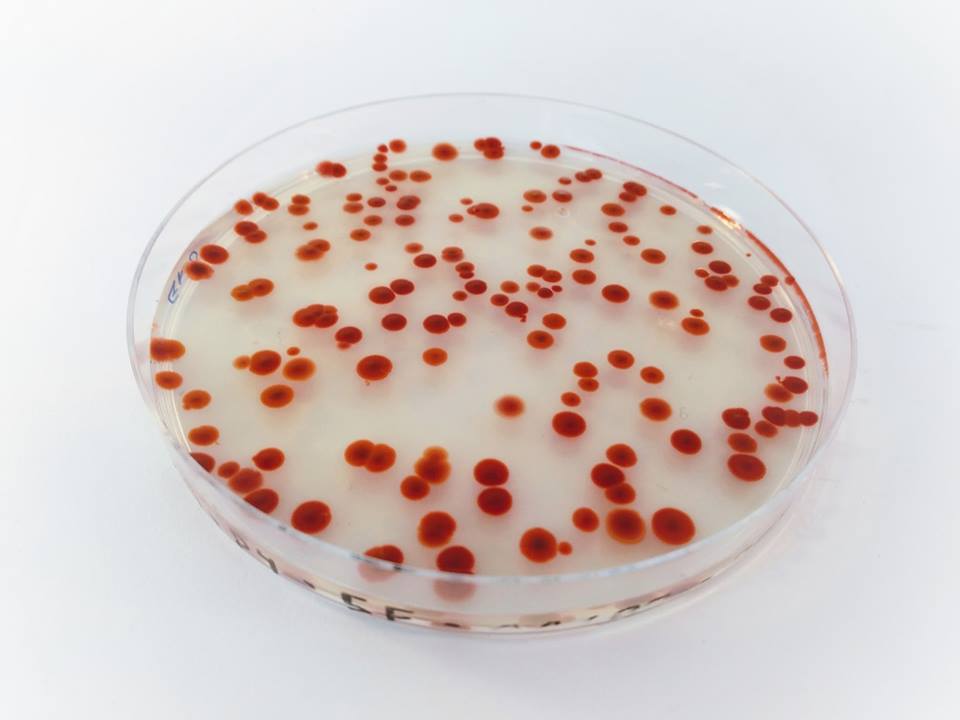 Serratia.jpg.c0817add8d2dfe69ce4dbfd739e52fa7.jpg