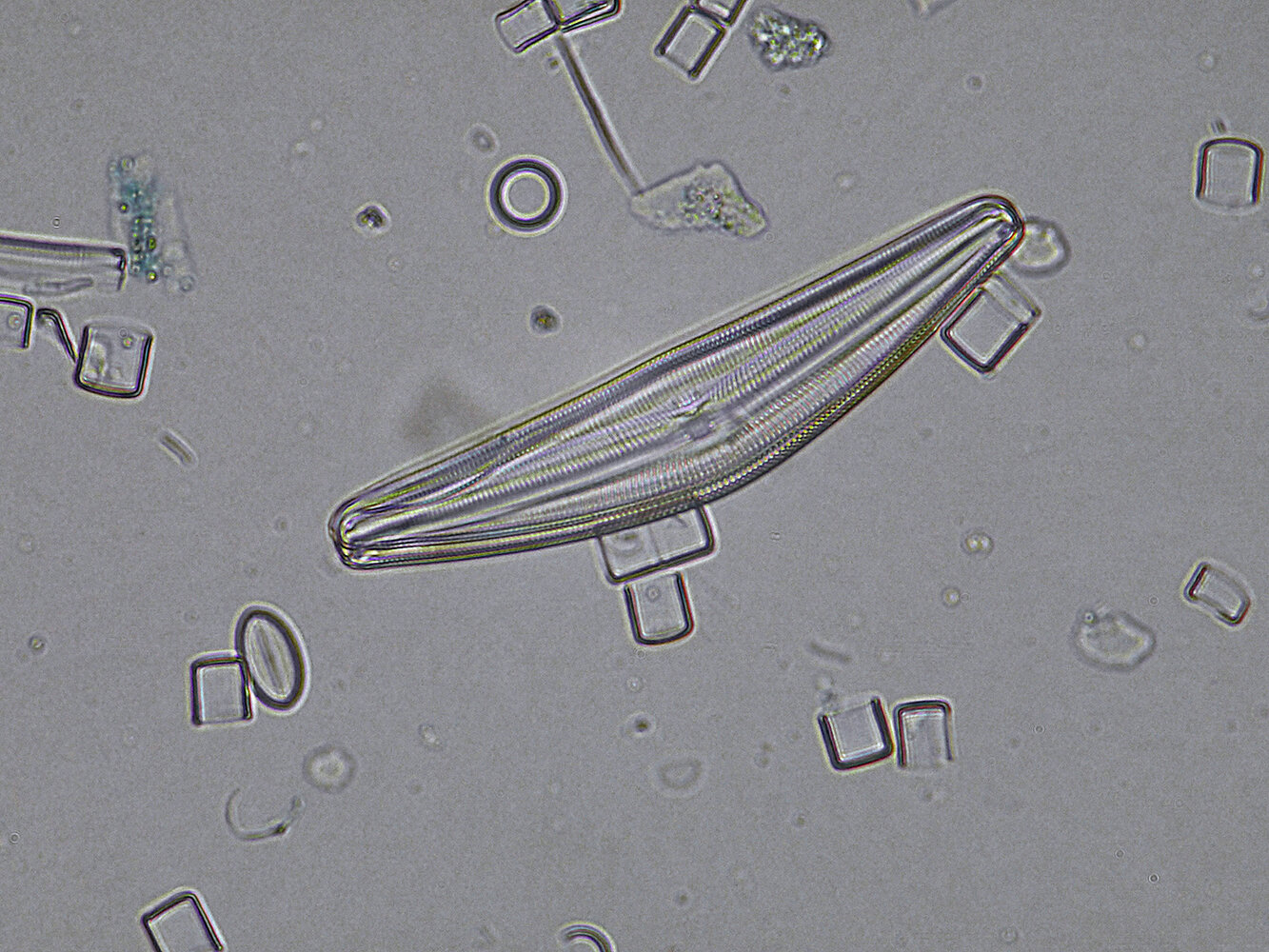diatomee_Lumix_40x_travaille_comme_dab_barlow-x2.thumb.jpg.b7cb190fbd0aaa6f387ea8f07731e89c.jpg